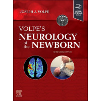 Neurología del recién nacido de Volpe